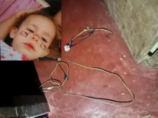 Criança de 2 anos morre após sofrer descarga elétrica dentro de casa em Machadinho do Oeste