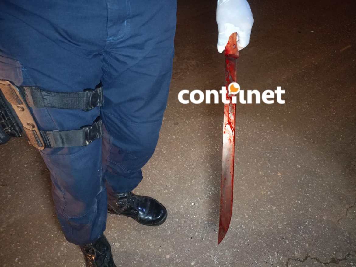 Durante surto violento, mulher ataca marido com terçado e vidro em Rio Branco