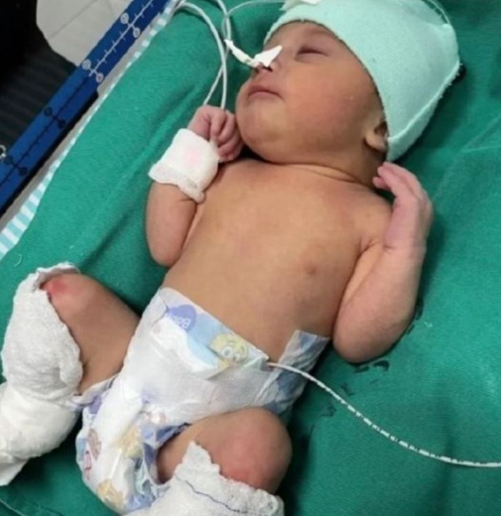 Bebê com suspeita de queimaduras em maternidade do Acre passa por avaliação neurológica após ficar 39 minutos sem batimentos