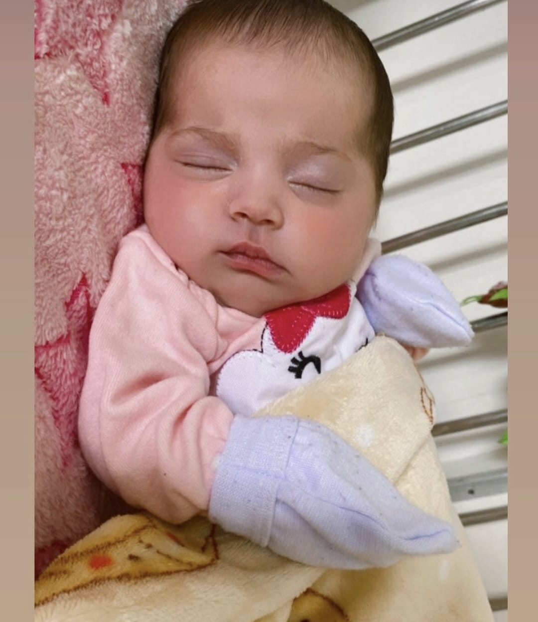 Recém-nascida Aurora que sofreu queimaduras em maternidade apresenta melhora e retira sonda
