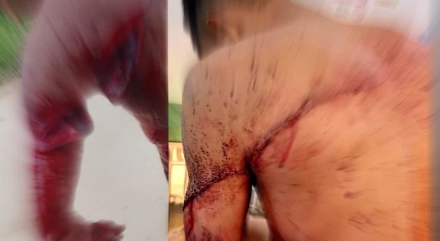 TARAUACÁ: HOMEM LEVA TERÇADADA DE CUNHADO NO BAIRRO TRIÂNFULO